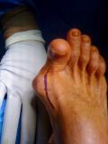 Before a completed podiatrist project in the area