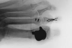 Before a completed podiatrist project in the area