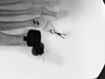 Before a completed podiatrist project in the area