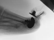 Before a completed podiatrist project in the area