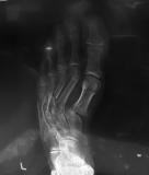 Before a completed podiatrist project in the area