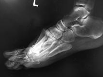 Before a completed podiatrist project in the area